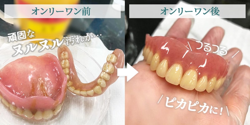 オンリーワン使用のビフォーアフター